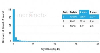 IGF2BP2 Antibody
