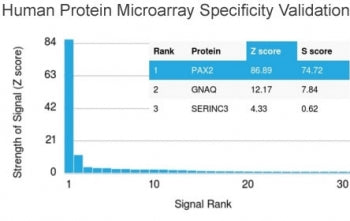 Analysis of HuProt(TM) microarray containing more than 19,000 full-length human proteins using PAX2 