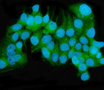 MEK2 Antibody / MAP2K2
