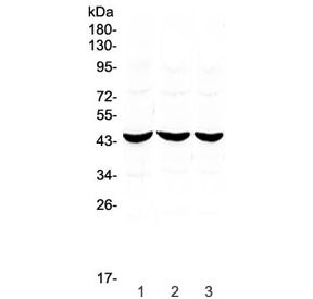 ADA Antibody / Adenosine deaminase