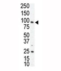 AXL Antibody