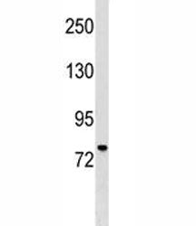 MUM1 Antibody