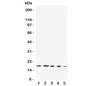 Western blot testing of FAT10 antibody and Lane 1: HeLa; 2: SKOV; 3: MCF-7; 4: A549; 5: SMMC-7721 ce