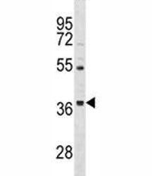 ORAI3 Antibody