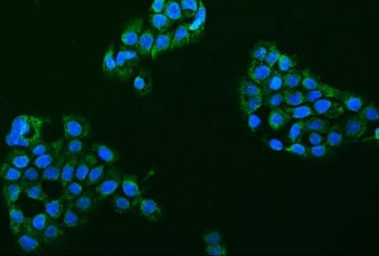 ACCN1 Antibody / ASIC2