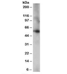 Western blot testing of human lung lysate with CORO1C antibody at 0.2ug/ml. Predicted molecular weig