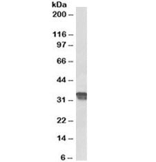 Cyclin D1 Antibody