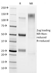 SDS-PAGE analysis of purified, BSA-free Helicobacter pylori antibody (clone HP/1336) as confirmation