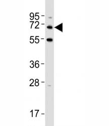 p62 Antibody