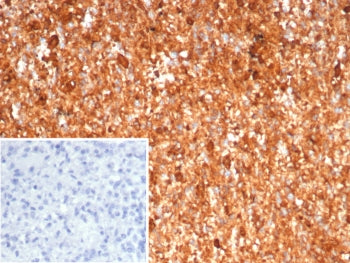 S100A9 Antibody / MRP14 / Calgranulin B / Calprotectin L1H