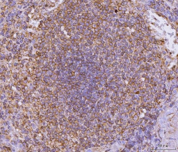 IHC staining of FFPE human spleen tissue with CD135 antibody. HIER: boil tissue sections in pH8 EDTA