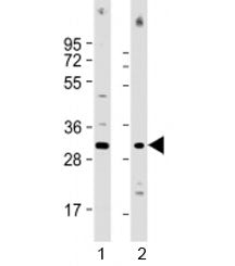 Western blot testing of human 1) Jurkat and 2) HL-60 cell lysate with COPS7B antibody at 1:1000. Pre