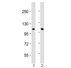 CLCN1 Antibody / Chloride channel protein 1 (N-Terminal Region)
