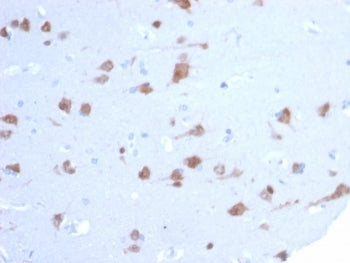 IHC staining of FFPE human brain tissue with RBFOX3 antibody (clone NEUN/7167). HIER: boil tissue se