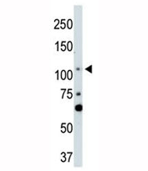 LATS2 Antibody