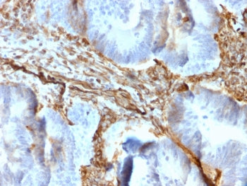 IHC staining of FFPE human colon tissue with recombinant VIM antibody (clone rVIM/6431). HIER: boil 