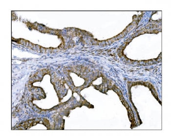 DLGAP1 Antibody / DAP-1
