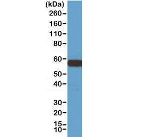 Western blot testing of 293 cell lysate with recombinant AKT1 antibody at 1:1000. Predicted molecula