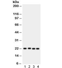 SOCS2 Antibody