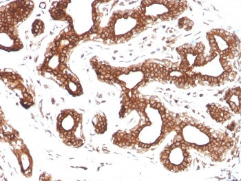 Calpastatin Antibody