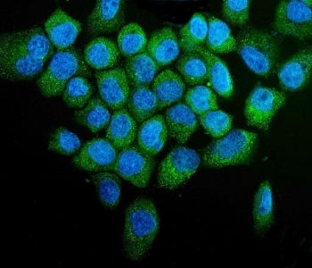 Immunofluorescent staining of FFPE human A431 cells with PTEN-induced kinase 1 antibody (green) and 