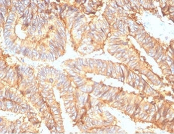 EpCAM Antibody