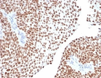 IHC staining of FFPE human bladder tissue with GATA Binding Protein 3 antibody (clone GATA3/6664). H