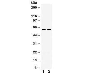 Western blot testing of 1) rat kidney and 2) human HeLa lysate with CCT3 antibody. Expected molecula