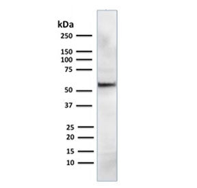 AKT1 Antibody