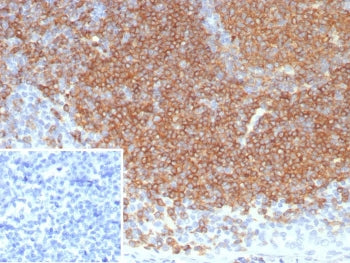 IHC staining of FFPE human tonsil tissue with CD22 antibody (clone BLCAM/8113R). Inset: PBS instead 