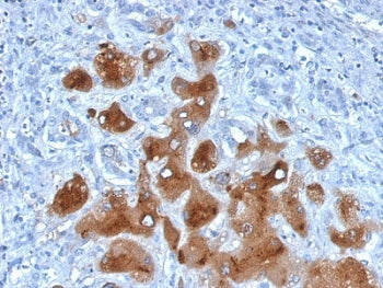 Serum Amyloid A Antibody / SAA1 + SAA2