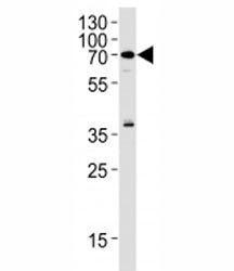 RIPK2 Antibody