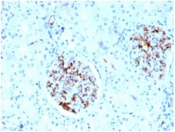 IHC staining of FFPE human kidney tissue with Fatty Acid Binding Protein 4 antibody (clone FABP4/442