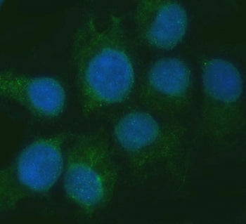 Immunofluorescent staining of FFPE human SiHa cells with RGS7 antibody (green) and DAPI nuclear stai