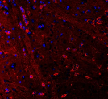 Immunofluorescent staining of FFPE rat brain tissue with PSD-95 antibody (red) and DAPI nuclear stai