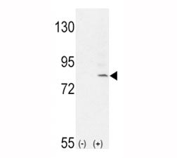 Western blot analysis of FGFR1 antibody and 293 cell lysate (2 ug/lane) either nontransfected (Lane 