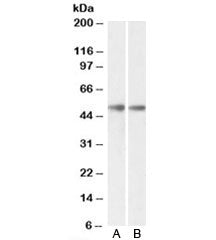 Western blot testing of mouse [A] and rat [B] brain lysates with GDE1 antibody at 0.3ug/ml. Predicte