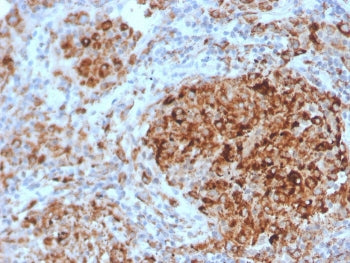 IHC staining of FFPE human lymph node with TIM3 antibody (clone TIM3/4028). HIER: boil tissue sectio