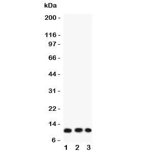 Western blot testing of human 1) COLO320, 2) A549 and 3) HT1080 lysate with Eotaxin antibody. Predic