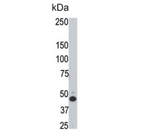 HtrA3 Antibody