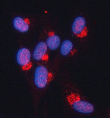 Immunofluorescent staining of FFPE human U-87 MG cells with Snurportin 1 antibody (red) and DAPI nuc