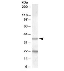 Western blot testing of human liver lysate with TUSC3 antibody at 1ug/ml. The expected ~37kDa band a