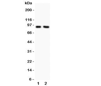 Western blot testing of NHE1 antibody and Lane 1: rat PC12; 2: human MCF-7. Predicted/observed size 