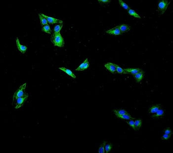 Beta Tubulin Antibody / TUBB