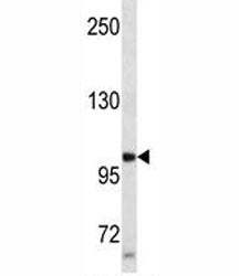 Progesterone Receptor Antibody