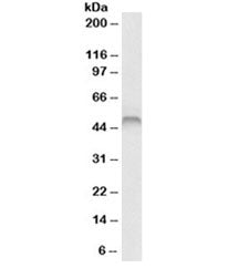 Western blot testing of human skeletal muscle lysate with Fascin antibody at 1ug/ml. Predicted molec