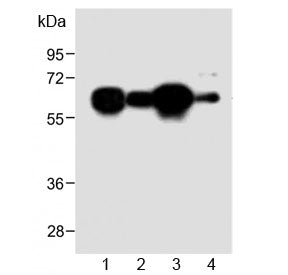 Western blot testing of human 1) HL60, 2) A431, 3) Jurkat and 4) mouse NIH3T3 cell lysate with METTL