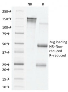 VEGF Antibody / Vascular Endothelial Growth Factor