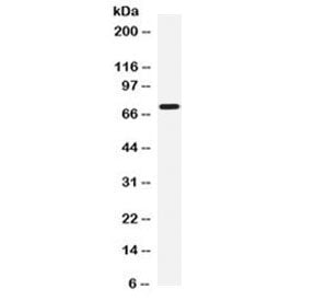 Western blot testing of human HepG2 cell lysate with CD212 antibody at 0.5ug/ml. Predicted molecular