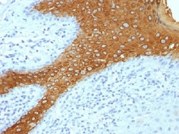 KRT10 Antibody Cocktail / Cytokeratin 10